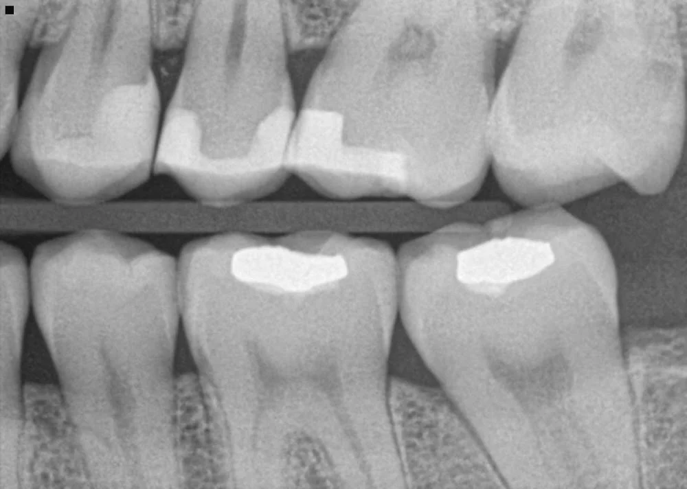 My Smiles Dental Center Picture 1