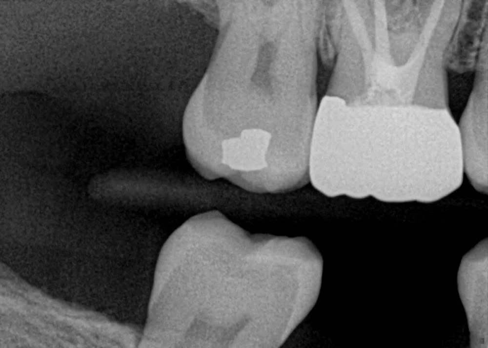 My Smiles Dental Center Picture 10