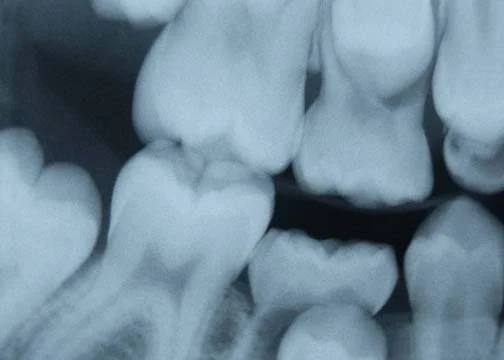 Popovich Dental Picture 4
