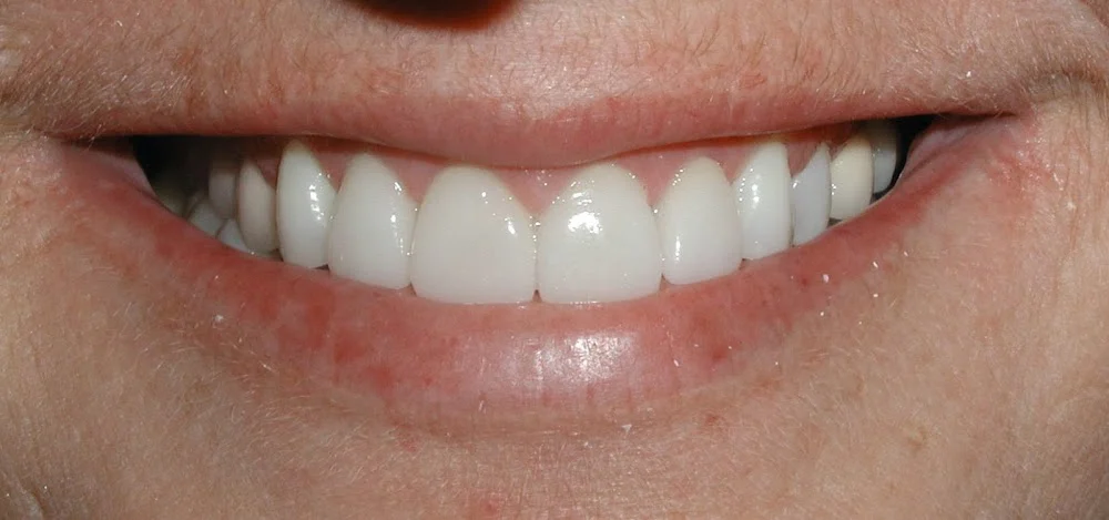 Meiners Dentistry Picture 8