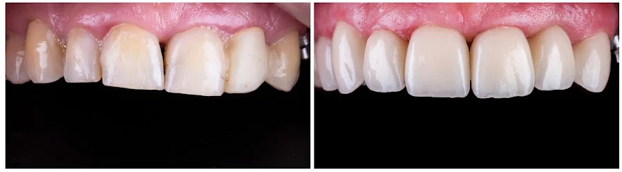 Plymouth Center for Dental Health and Wellness Picture 7