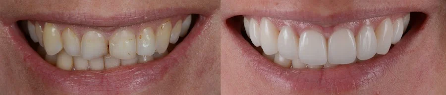 Plymouth Center for Dental Health and Wellness Picture 2