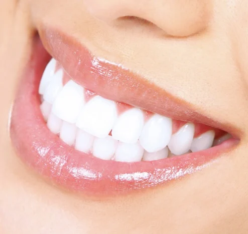 603 Dental Picture 3