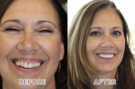 PS Smile Dental Picture 9