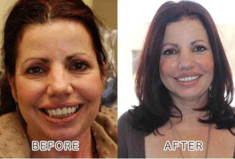 PS Smile Dental Picture 8