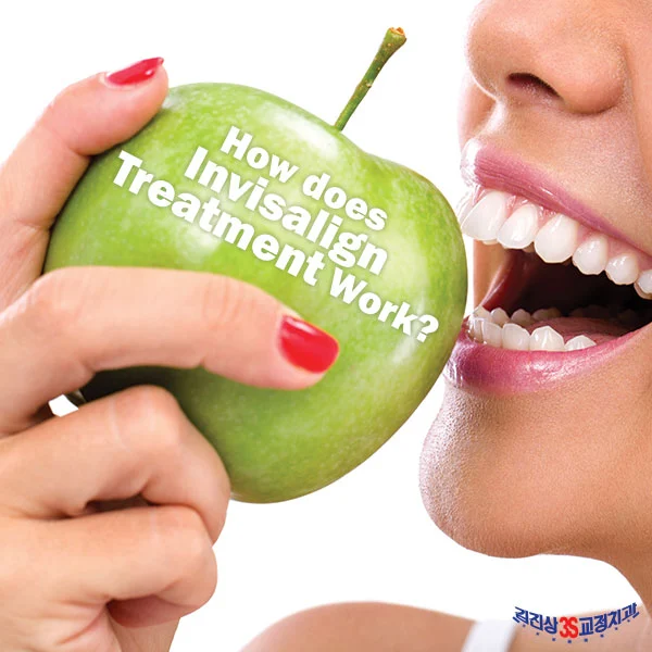 3S Orthodontics | Jinsang Kim DDS | 교정치과 | 뉴저지치과 Picture 7