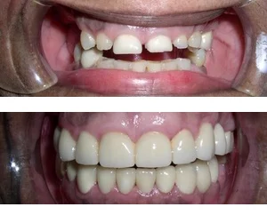 Bruce G Freund, DDS - A Dental365 Company Picture 6