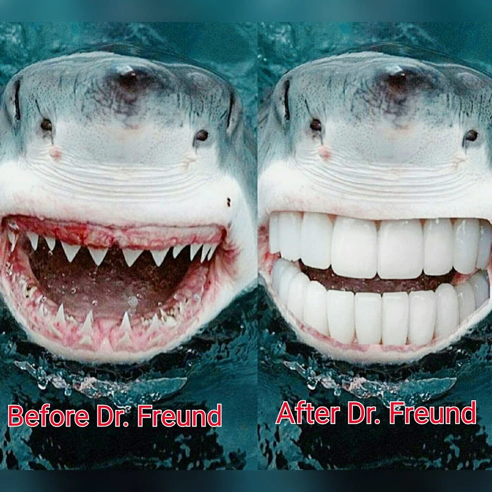 Bruce G Freund, DDS - A Dental365 Company Picture 7