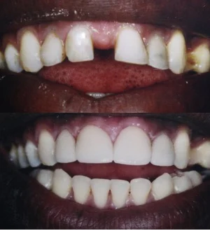 Bruce G Freund, DDS - A Dental365 Company Picture 2