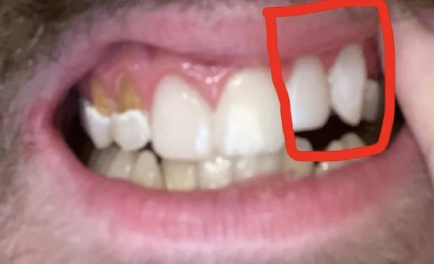 David A. Goodman, DMD Alan C. Ko, DMD Advanced Cosmetic & Prosthetic Dentistry Picture 9