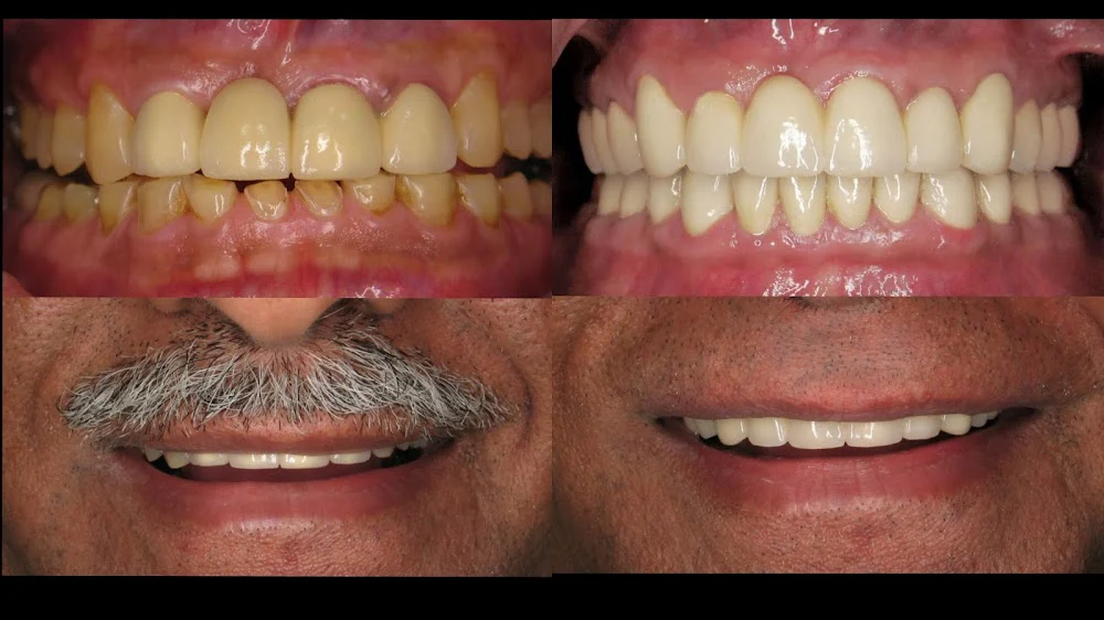 Ash Estafan DDS, Port Smiles Picture 2