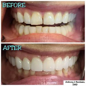 Randazzo Dental Associates of Saddle Brook Picture 2