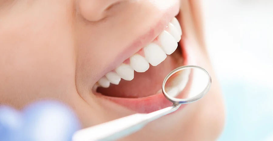 Smiley Teeth Dental Picture 2
