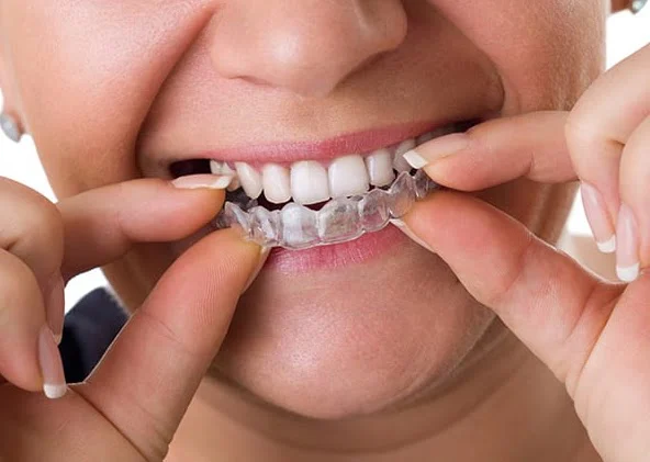 Gentle Dental Service Picture 1