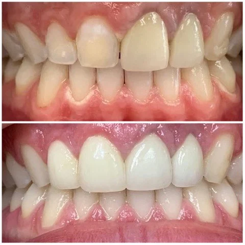 Dental Aesthetics | Dr. Sarah Mourad Picture 7