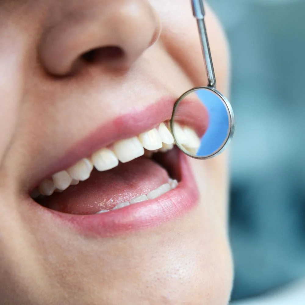 My Smile Dental Picture 7