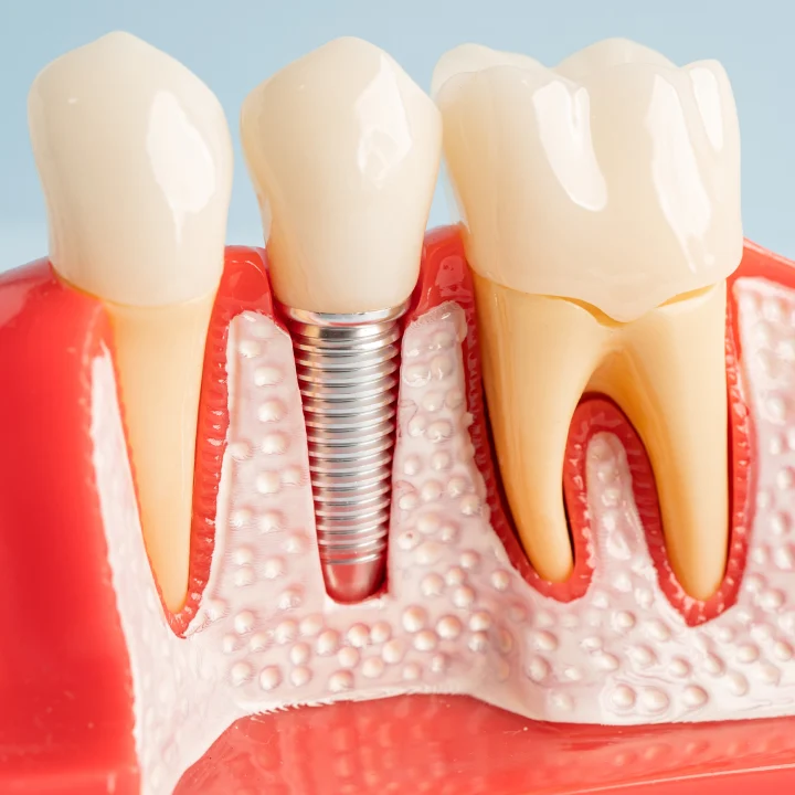 Finesse Dental Care Picture 2