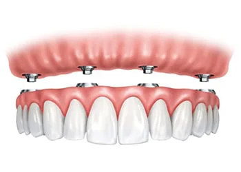 Quantum Dental Group Picture 4