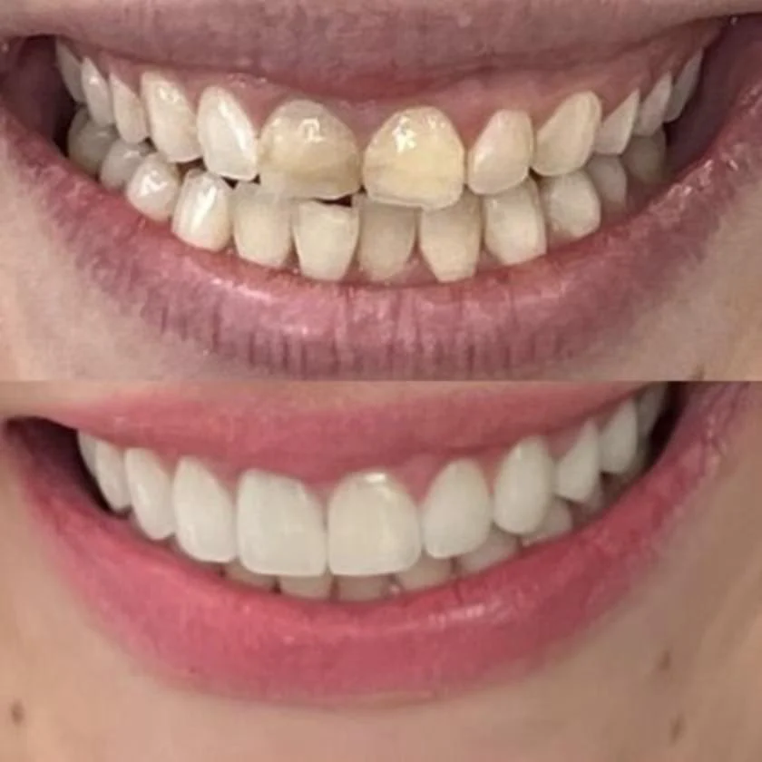 Green Pond Dental Associates: Bracha Lubart DDS and Elli Schulman DDS Picture 4