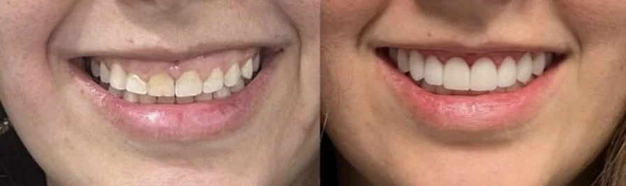 Green Pond Dental Associates: Bracha Lubart DDS and Elli Schulman DDS Picture 9