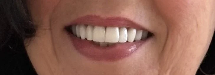 Aesthetic Dental Creations Picture 9
