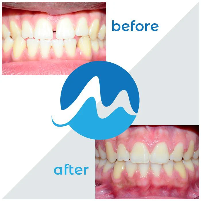 Monmouth-Ocean Orthodontics Picture 10
