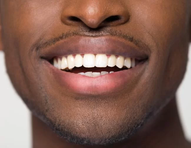 Does Acidic Food and Drink Affect the Enamel on Your Teeth? - Dentistry Toothtruth