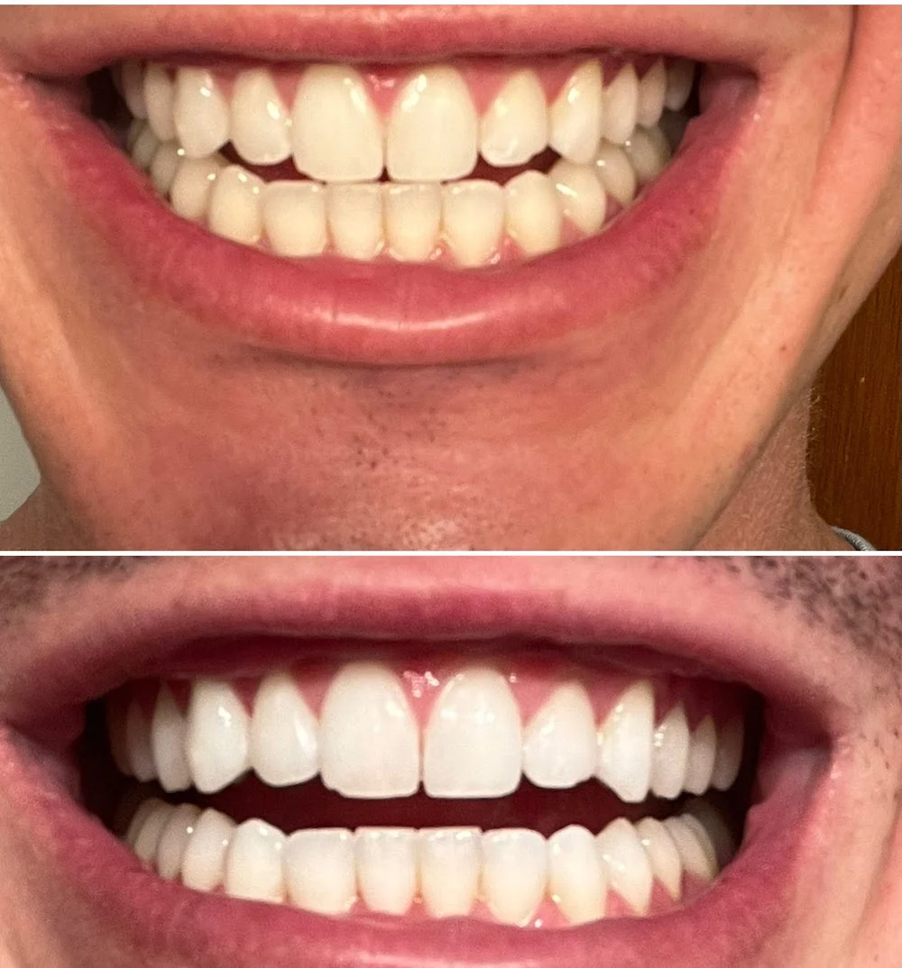 Tollgate Orthodontics Picture 9