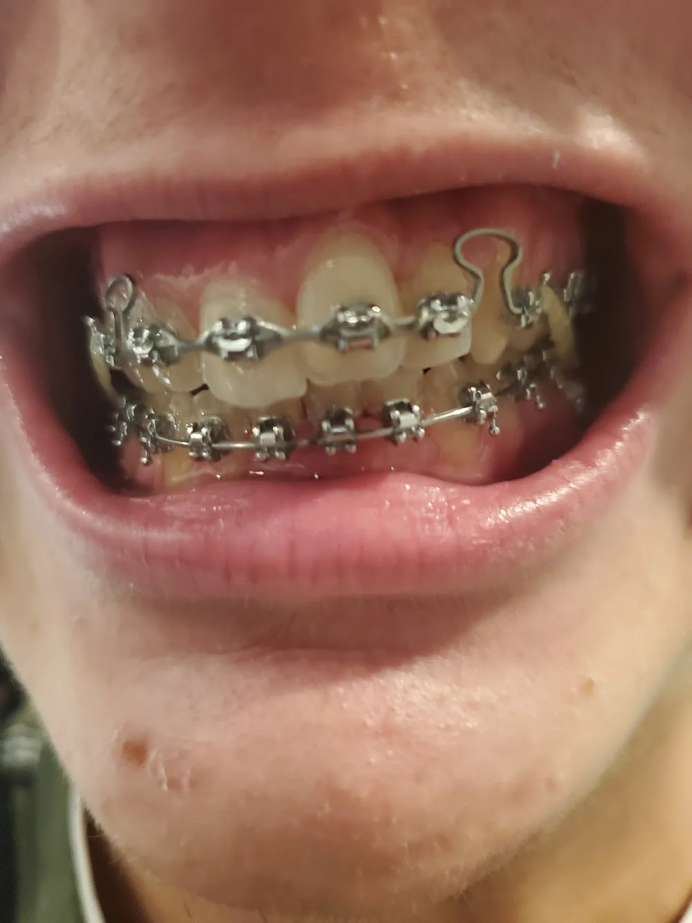 Picture Perfect Smile Picture 6