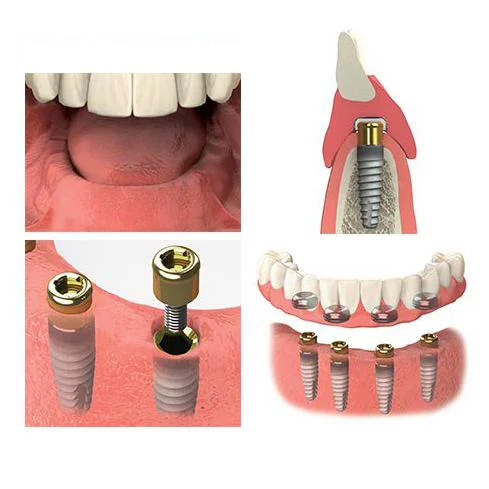 Fay Dental Picture 2