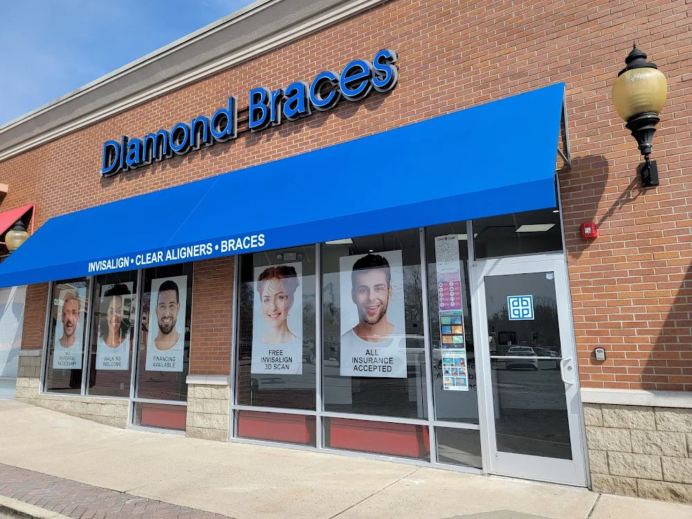 Diamond Braces Orthodontist: Braces & Invisalign Picture 4
