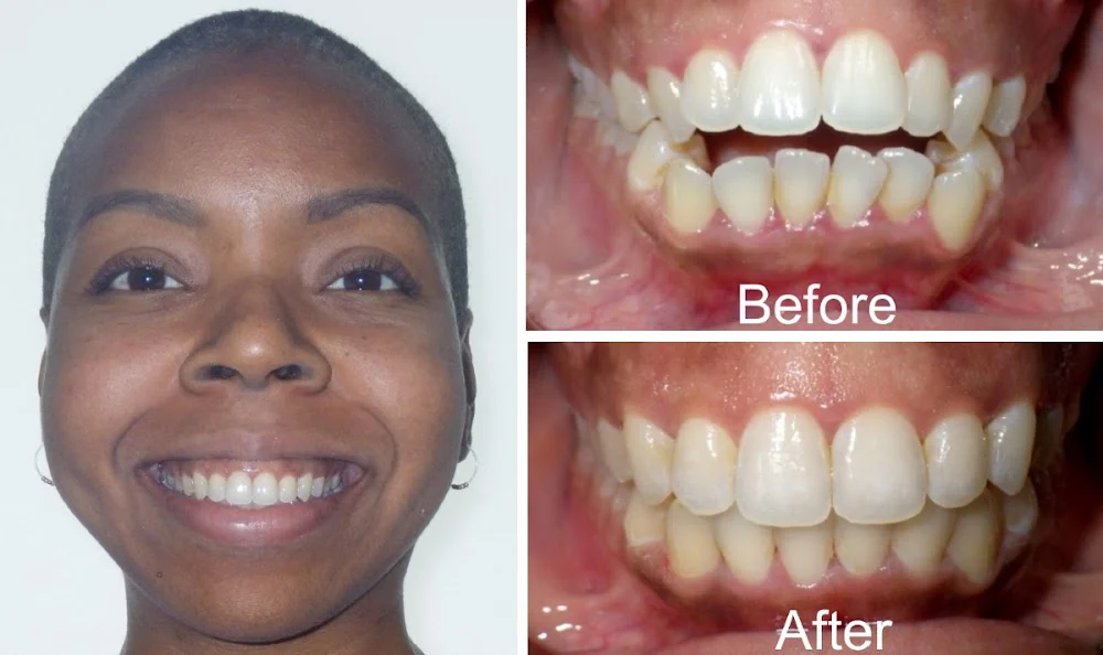 Diamond Braces Orthodontist: Braces & Invisalign Picture 10