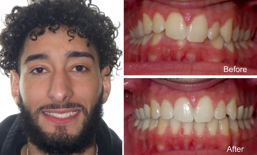 Diamond Braces Orthodontist: Braces & Invisalign Picture 8