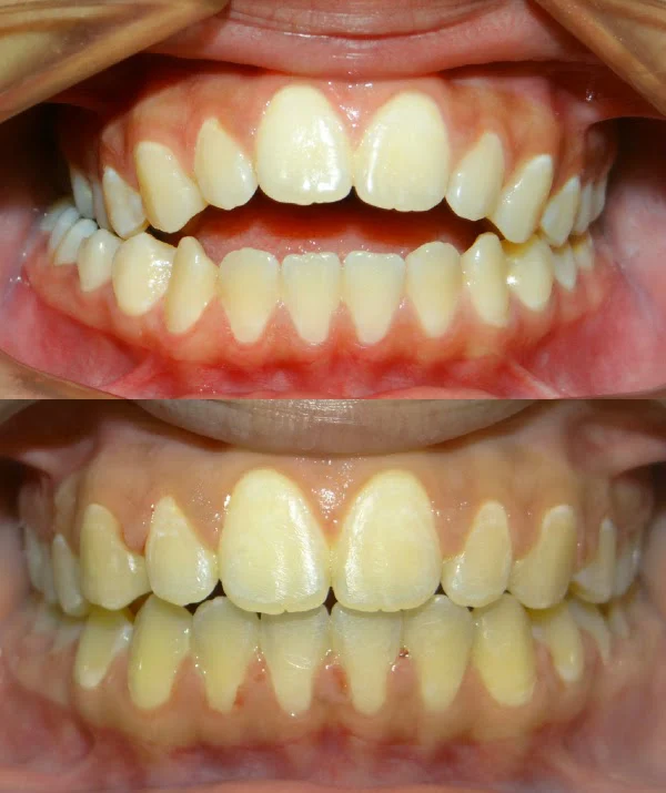 Diamond Braces Orthodontist: Braces & Invisalign Picture 9