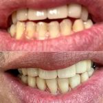 TK Dental Wayne, NJ | General, Cosmetic, Restorative Dentists. Dental Implants, Crowns, Bridges | Tatyana Kaminar DDS