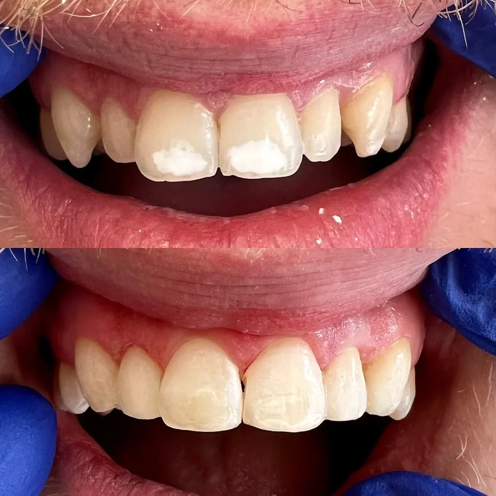 TK Dental Wayne, NJ | General, Cosmetic, Restorative Dentists. Dental Implants, Crowns, Bridges | Tatyana Kaminar DDS Picture 8