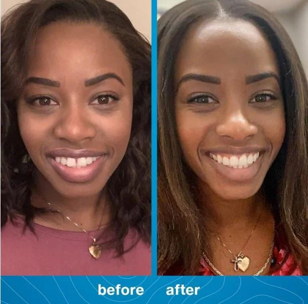 Shady Brook Family Dental Picture 10