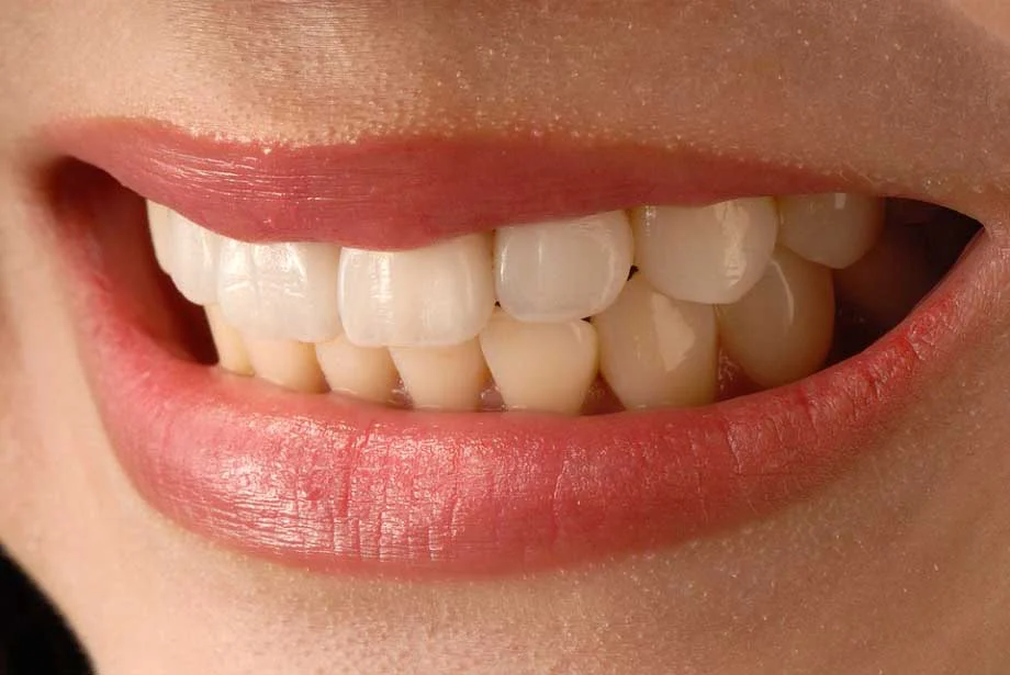 Chalet Dental Care Picture 10