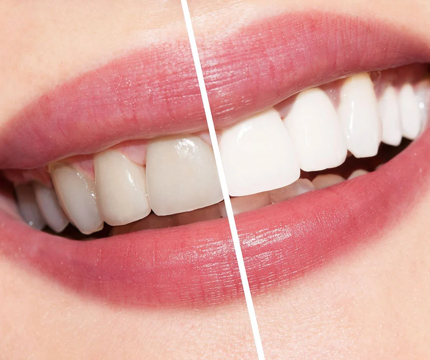 Fifth Avenue Dental Picture 7