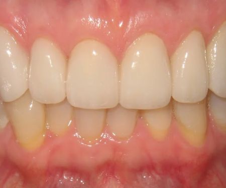 Cahill Dental Care