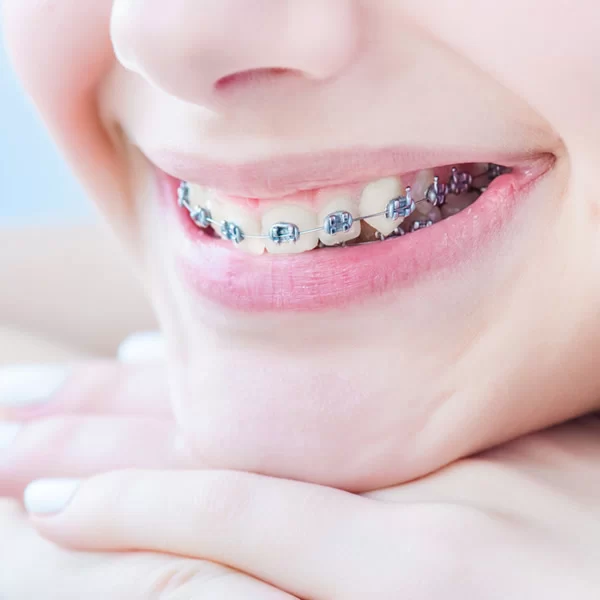 Orthodontics