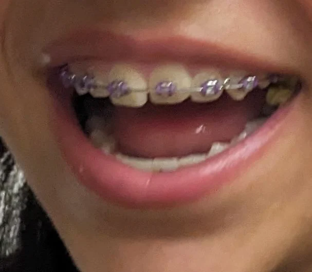 Central Dental Picture 9