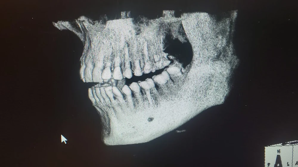 Emergency Dental Care USA Picture 9