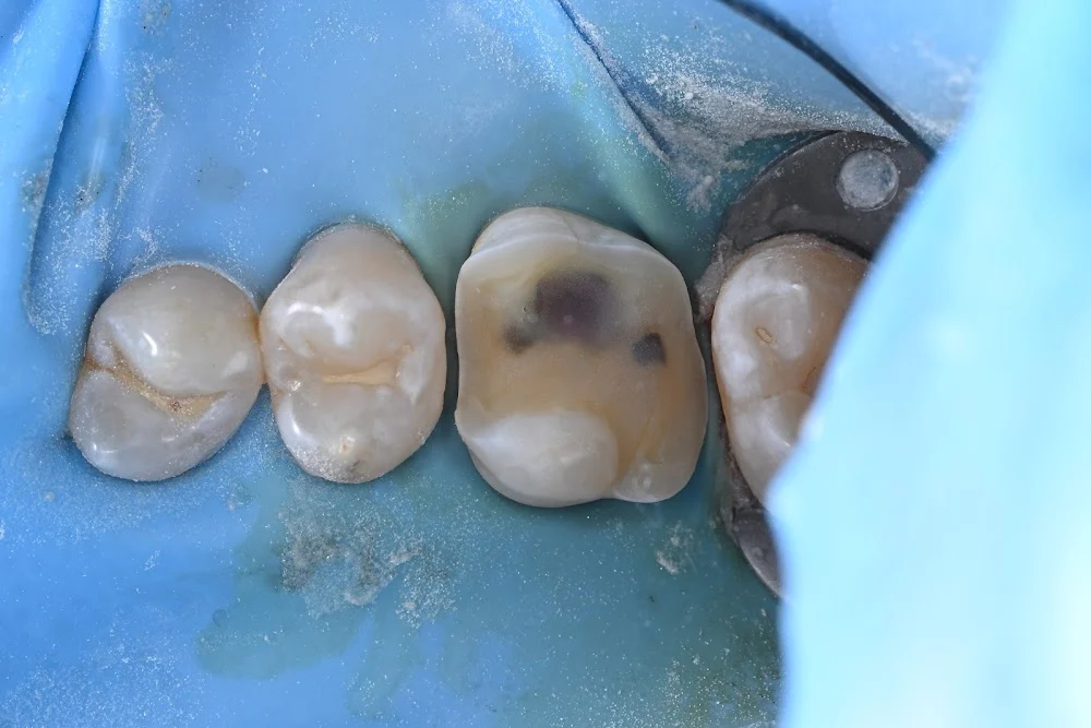 Associated Dentists Picture 9