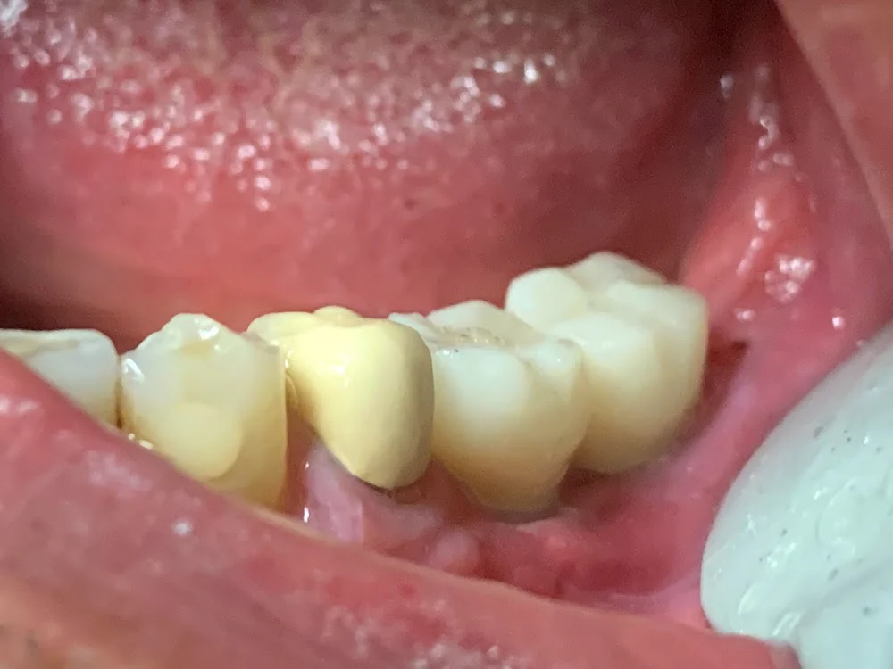 Almond Dental Maple Grove Picture 4