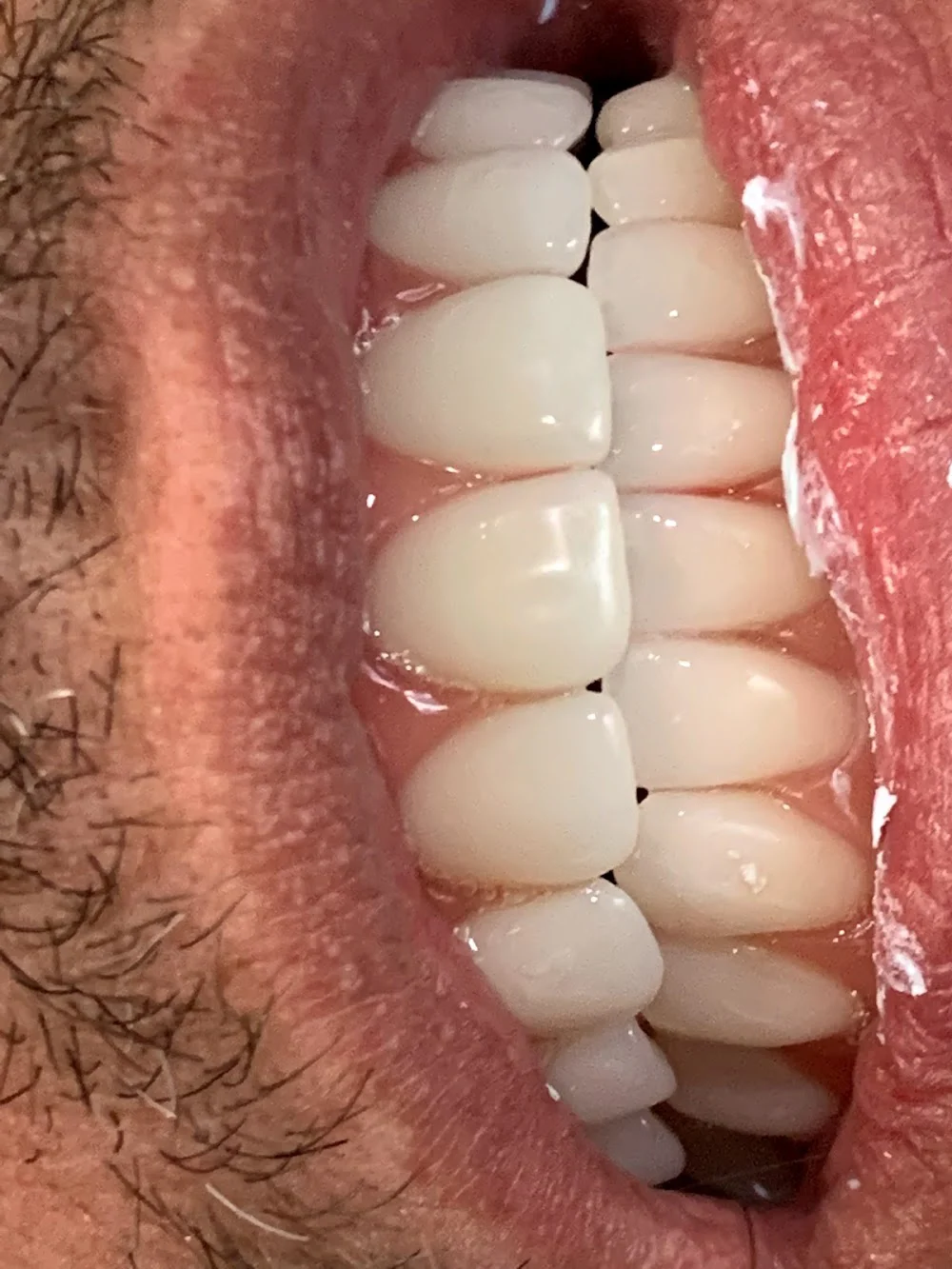 Almond Dental Maple Grove Picture 10