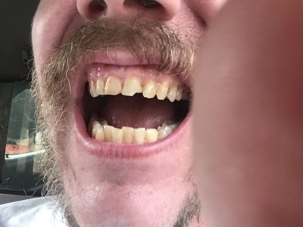 Gentle Dentistry Picture 4