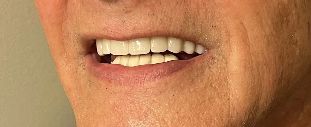 Palatine Dental Associates Picture 7