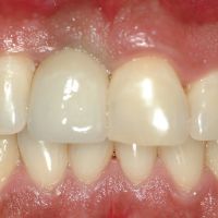 Robert S. Radin, DDS ico