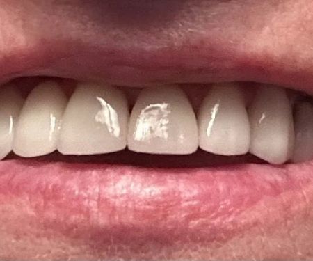 Lind Dental Care